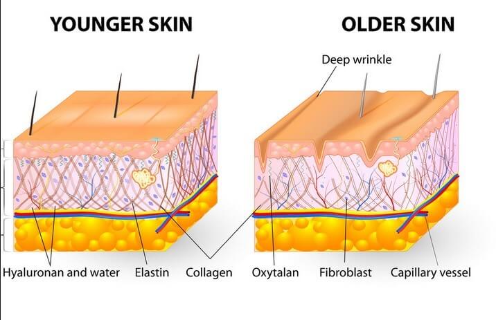 Cấu trúc da khi lão hóa do collagen và elastin bị suy giảm